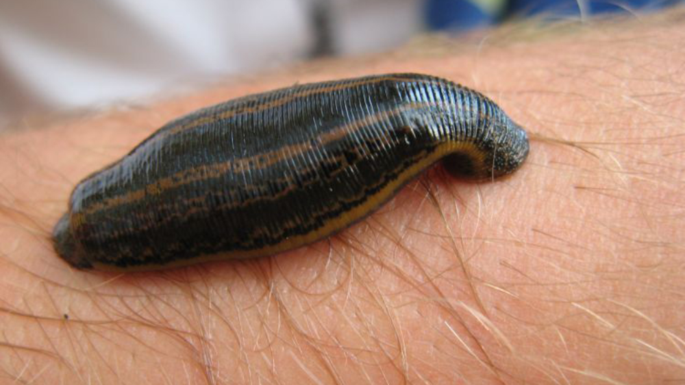leech-therapy-img